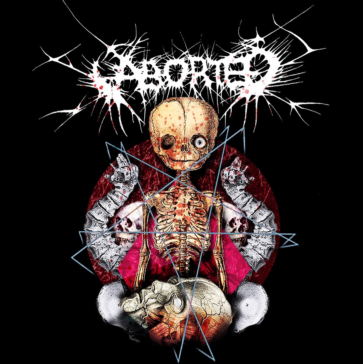 Aborted